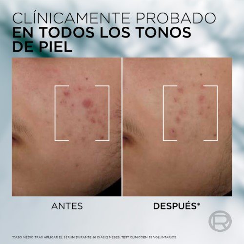 DG94031 ATF SERUM 3 2400x2400